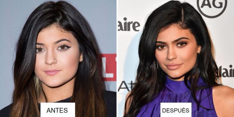 KYLIE JENNER