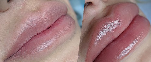 Micropigmentación de labios en Asturias